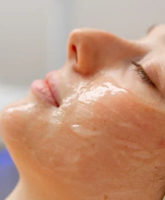 cosmetic-procedure-to-rejuvenate-the-skin-of-the-f-2024-11-27-02-39-30-utc